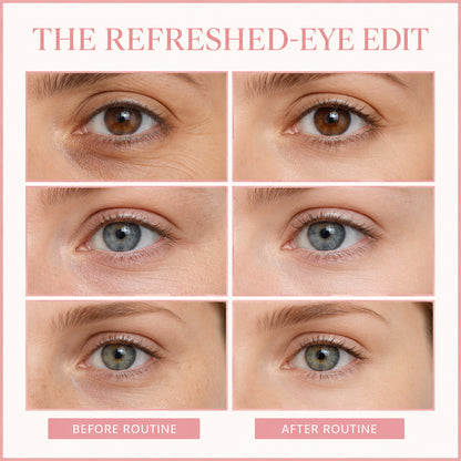 Collagen Eye Lift