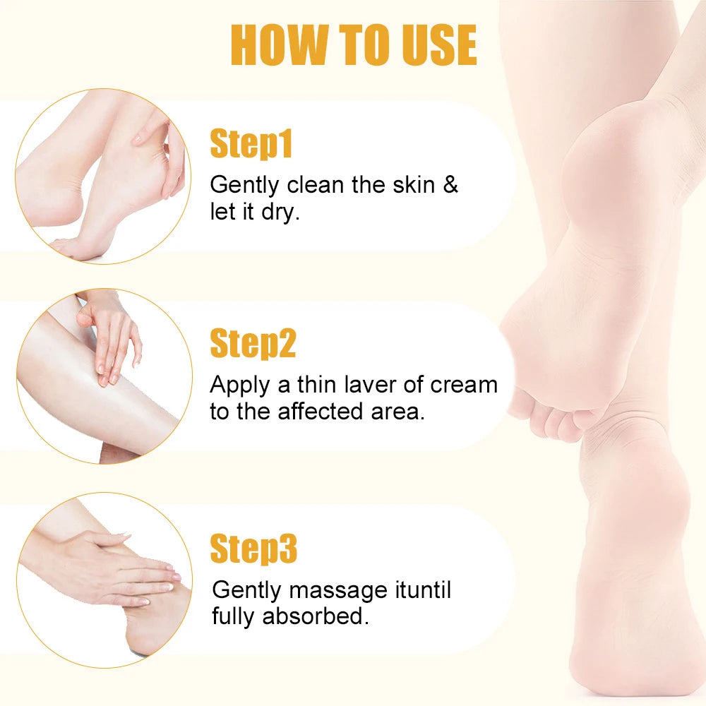 Urea Foot Repair